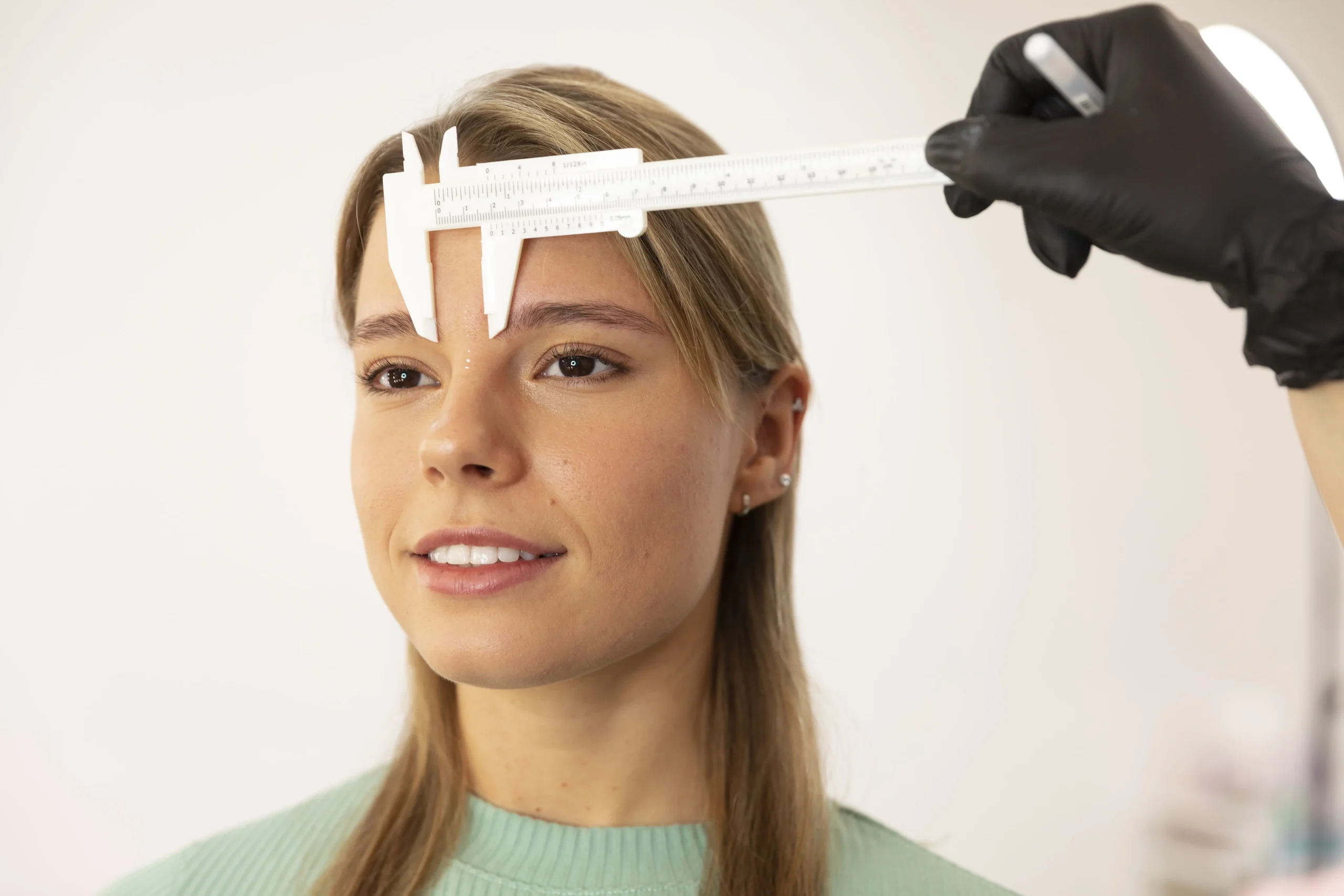Resultados de injerto de cejas en Sevilla Dra Aguilar