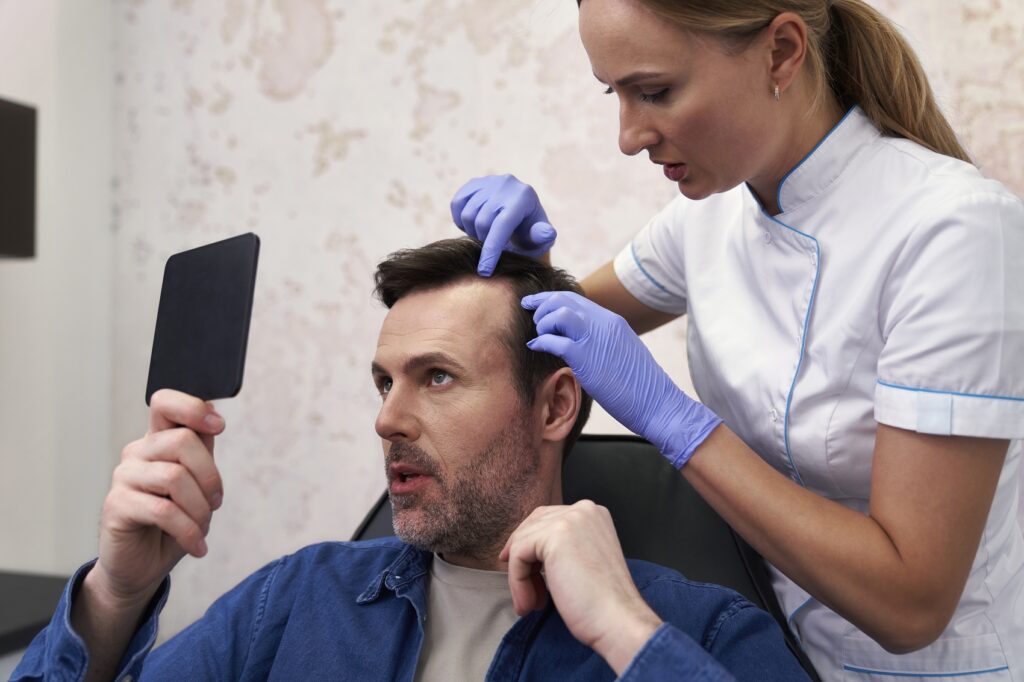 paciente con alopecia antes de injerto capilar en Sevilla
