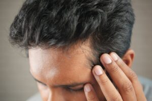Primer plano de la linea frontal y las entradas de un hombre antes de un injerto capilar